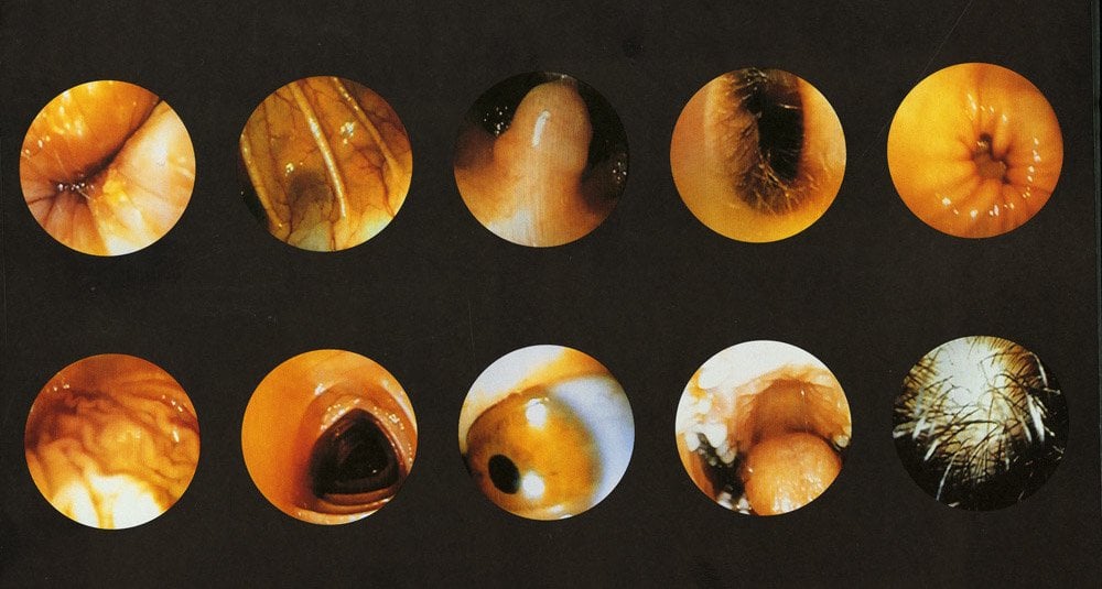 Photo of set Corps Étranger.