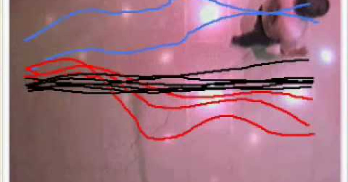 Galvanic Vestibular Stimulation 43